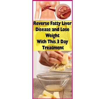 Fatty Liver Disease Weight Loss